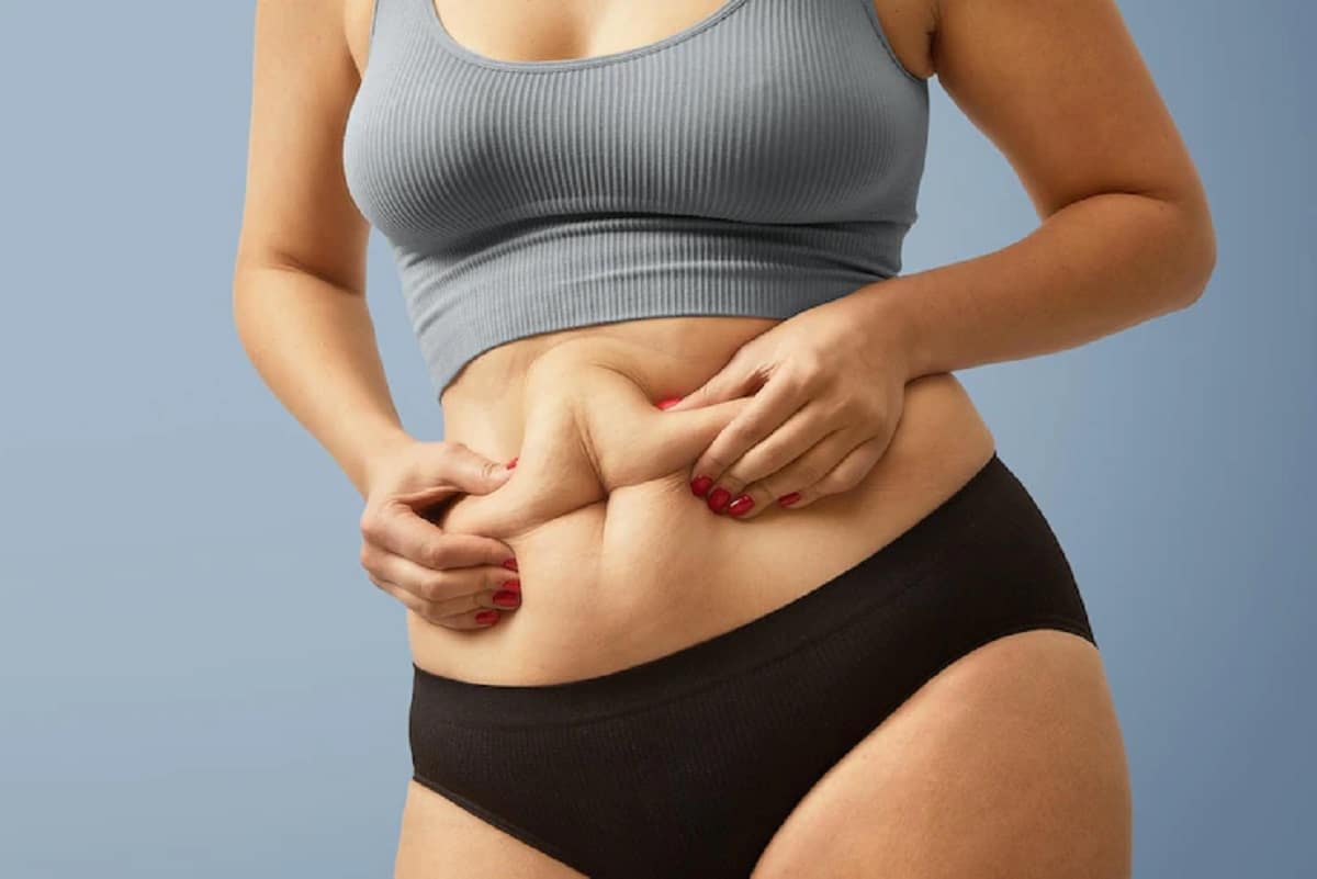 cellulite sur le ventre.jpg