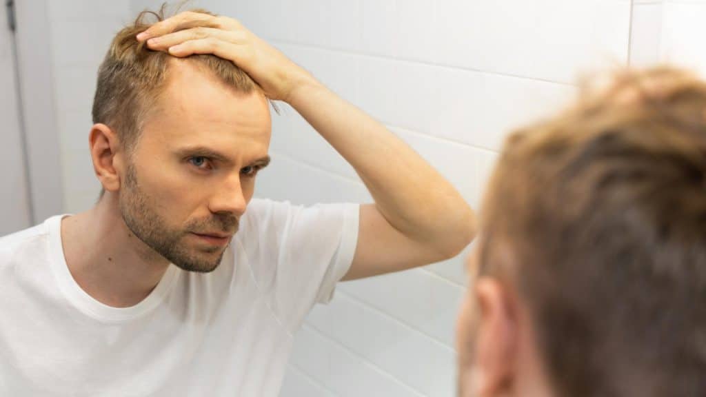 un homme perd ses cheveux