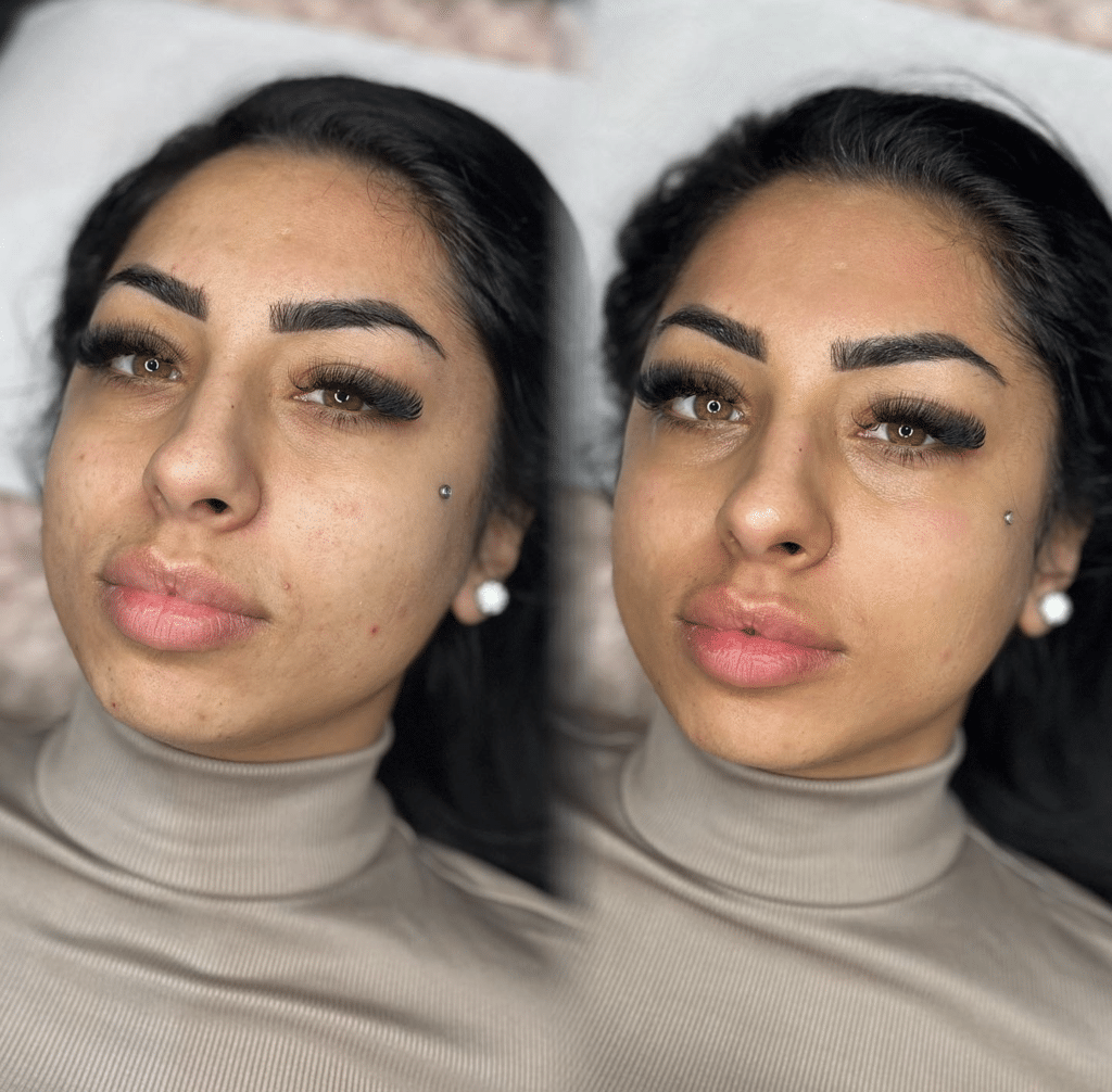 bb glow avant apres 2
