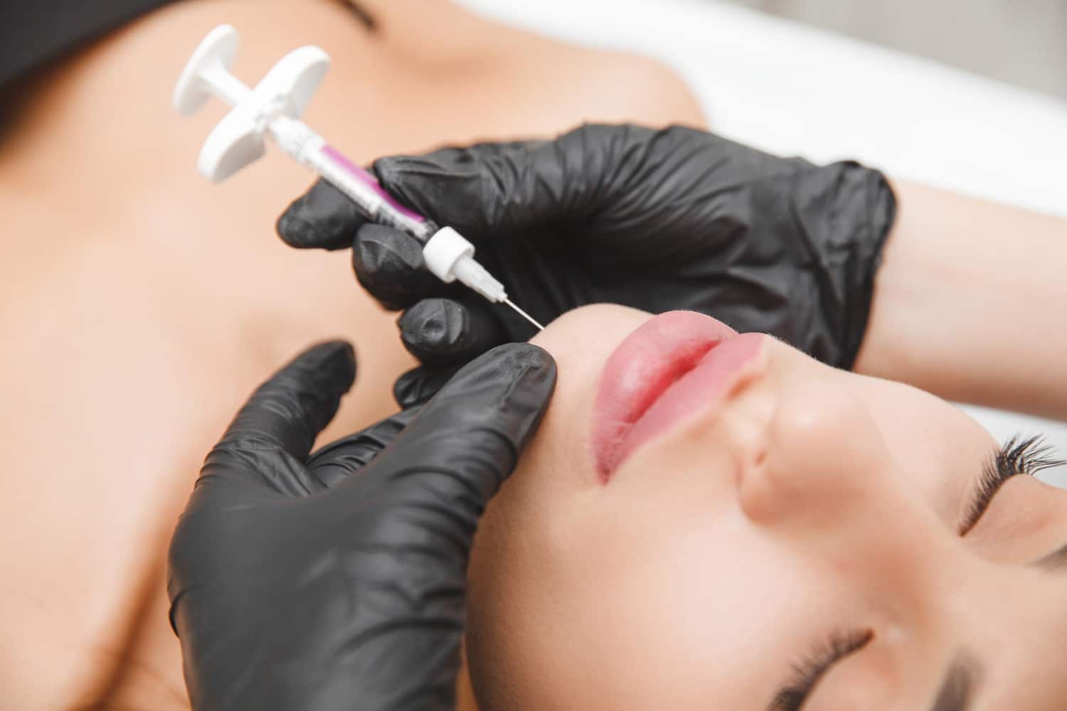 chirurgie double menton