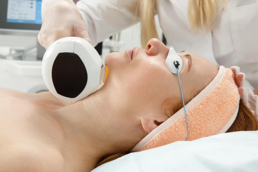 Cryolipolyse contre le double menton