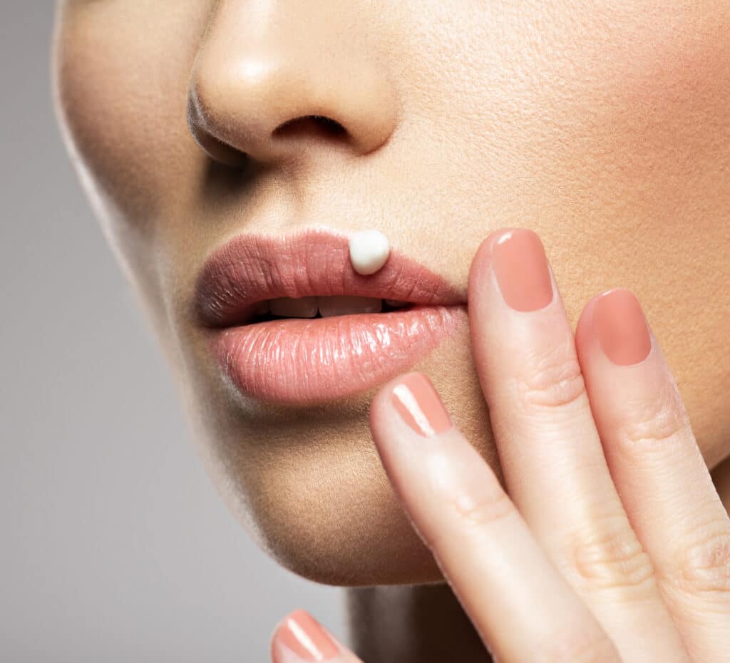 Herpès labial traitement