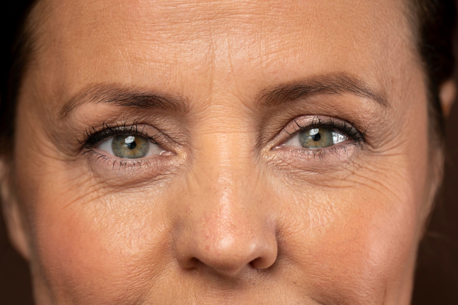 femme avec un vieillissement de la peau