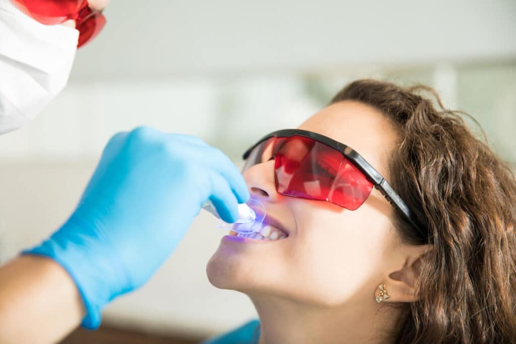 blanchiment des dents
