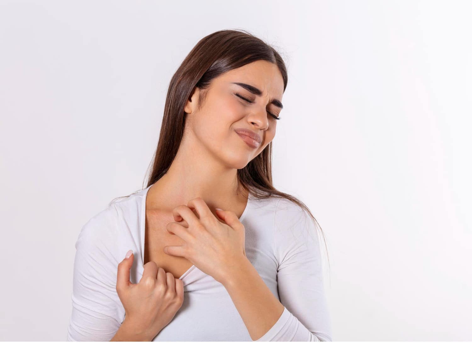 psoriasis