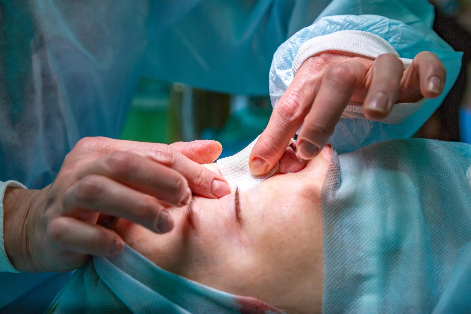 rhinoplastie ultrasonique